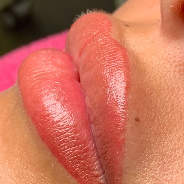Lippen